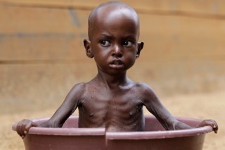 Somali CHild - Urban Hunger Crisis. Source Veterans Today (13K)