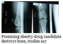 bones (26K)
