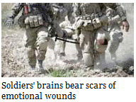 Soldier'sBrain (22K)
