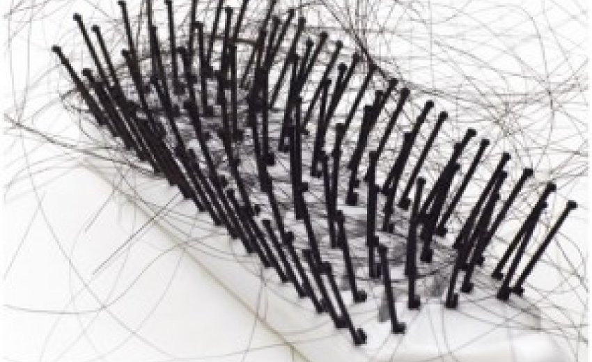 Hair Loss And Thinning Solutions Sikhnet