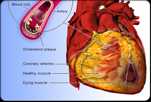 Heart (40K)