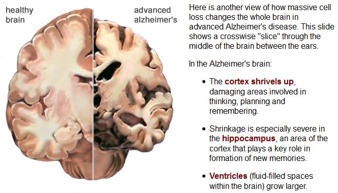 BrainChanges (198K)