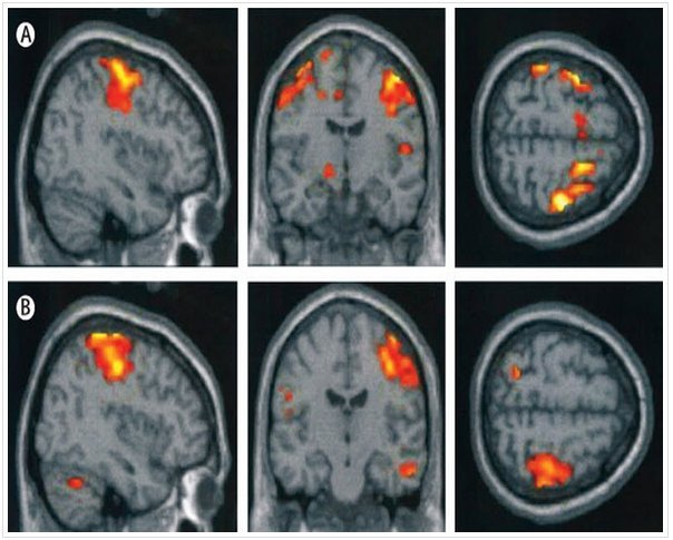 BrainImgs (60K)