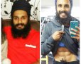Dr. Harbir Singh Ji - Before and After